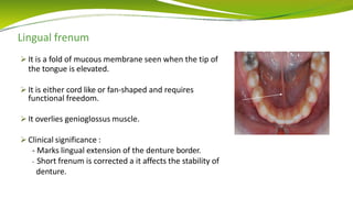 Lingual frenum
 It is a fold of mucous membrane seen when the tip of
the tongue is elevated.
 It is either cord like or fan-shaped and requires
functional freedom.
 It overlies genioglossus muscle.
 Clinical significance :
- Marks lingual extension of the denture border.
- Short frenum is corrected a it affects the stability of
denture.
 