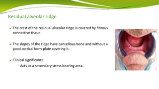 Residual alveolar ridge
 The crest of the residual alveolar ridge is covered by fibrous
connective tissue
 The slopes of the ridge have cancellous bone and without a
good cortical bony plate covering it.
 Clinical significance
- Acts as a secondary stress bearing area.
 