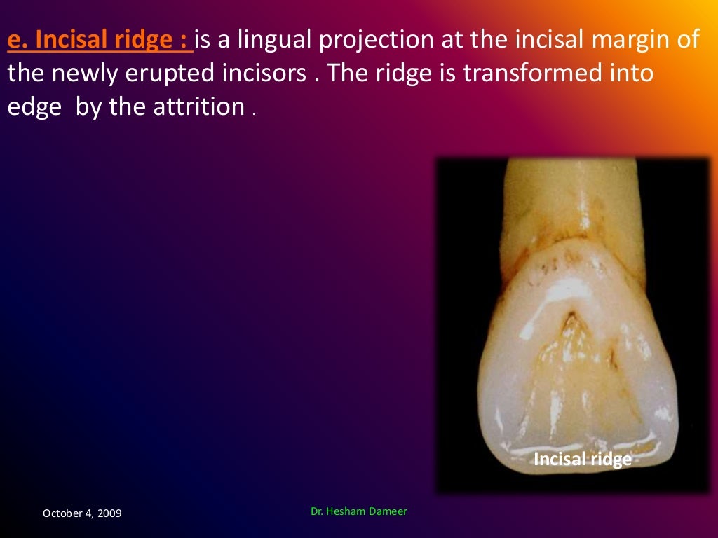 Anatomical landmarks of the crown