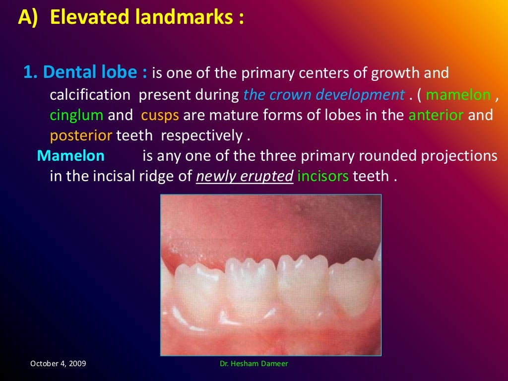Anatomical landmarks of the crown