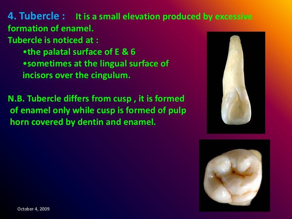 Anatomical landmarks of the crown