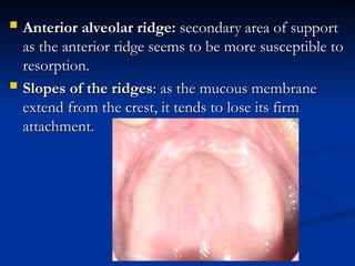 ANATOMICAL LANDMARKS RELATED TO COMPLETE DENTURES1.ppt