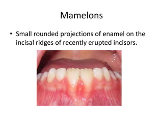 Mamelons
• Small rounded projections of enamel on the
incisal ridges of recently erupted incisors.
 
