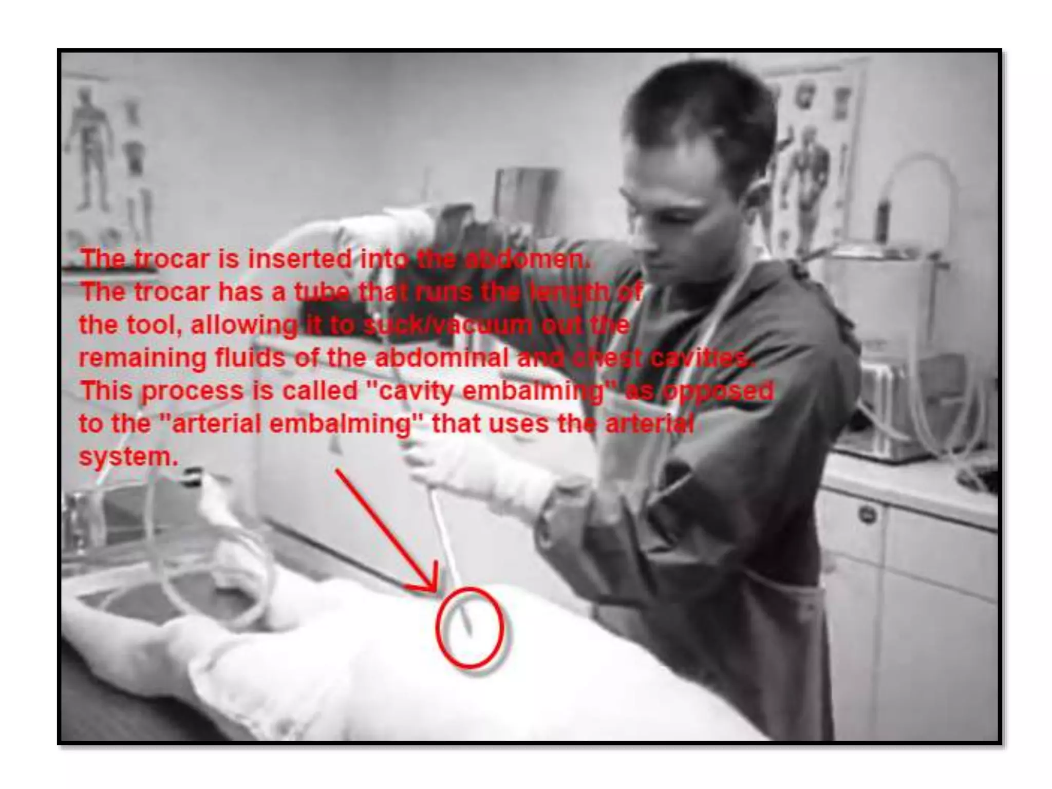 Anatomical techniques | PPTX