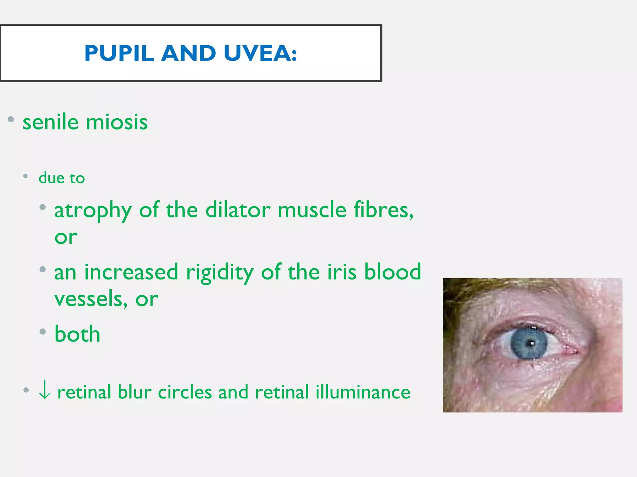 Anatomic and physiological ocular changes with age final | PPT