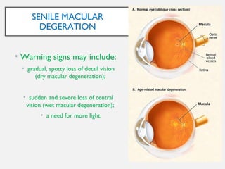 Anatomic and physiological ocular changes with age final | PPT