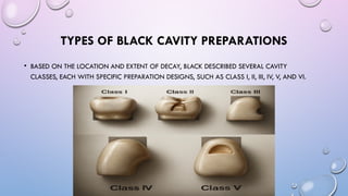 Anatomic Classification of Cavities 02.pptx