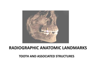 RADIOGRAPHIC ANATOMIC LANDMARKS
TOOTH AND ASSOCIATED STRUCTURES
 