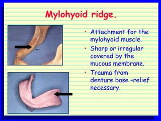 Anatomic landmarks of maxillary and mandibular arches.ppt