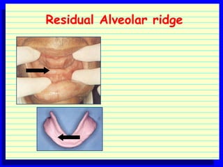 Anatomic landmarks for B.D.S students | PPT