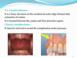 ANATOMIC LANDMARKS OF MAXILLA.pptx