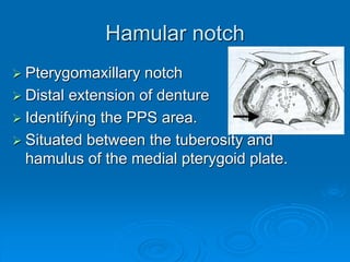 Hamular notch
 Pterygomaxillary notch
 Distal extension of denture
 Identifying the PPS area.
 Situated between the tuberosity and
hamulus of the medial pterygoid plate.
 