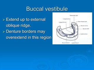 Buccal vestibule
 Extend up to external
oblique ridge.
 Denture borders may
overextend in this region
 