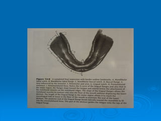 Anatomic LandmarkT.PPT