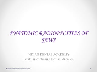 ANATOMIC RADIOPACITIES OF
JAWS
INDIAN DENTAL ACADEMY
Leader in continuing Dental Education
www.indiandentalacademy.com
 
