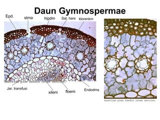 Daun Gymnospermae
Epd. stma hipdm Sal. hars klorenkm
Endodms
xilem floem
Jar. transfusi
 