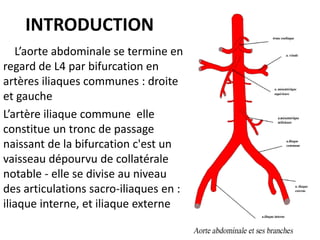 INTRODUCTION
L’aorte abdominale se termine en
regard de L4 par bifurcation en
artères iliaques communes : droite
et gauche
L’artère iliaque commune elle
constitue un tronc de passage
naissant de la bifurcation c'est un
vaisseau dépourvu de collatérale
notable - elle se divise au niveau
des articulations sacro-iliaques en :
iliaque interne, et iliaque externe
 