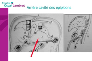 Arrière cavité des épiploons 