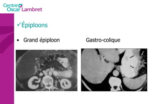Épiploons Grand épiploon Gastro-colique 