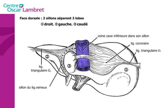  droit ,   gauche ,   caudé Face dorsale : 2 sillons séparent 3 lobes lig. triangulaire G.    lig. triangulaire  D. lig .  coronaire veine cave inférieure dans son sillon sillon du lig.veineux 