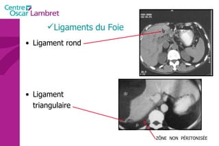Ligaments du Foie Ligament rond Ligament triangulaire ZÔNE  NON  PÉRITONISÉE 
