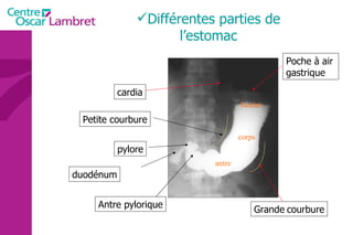 Différentes parties de l’estomac cardia Petite courbure Grande   courbure pylore antre fundus Antre pylorique duodénum Poche à air   gastrique corps 