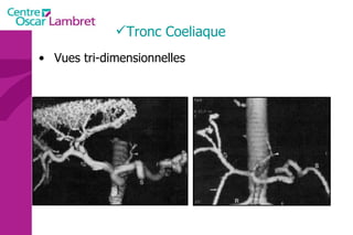 Tronc Coeliaque Vues tri-dimensionnelles 