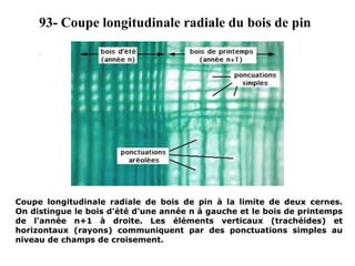 93- Coupe longitudinale radiale du bois de pin
Coupe longitudinale radiale de bois de pin à la limite de deux cernes.
On distingue le bois d'été d'une année n à gauche et le bois de printemps
de l'année n+1 à droite. Les éléments verticaux (trachéides) et
horizontaux (rayons) communiquent par des ponctuations simples au
niveau de champs de croisement.
.
 