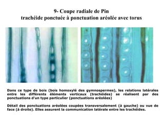 9- Coupe radiale de Pin
trachéide ponctuée à ponctuation aréolée avec torus
Dans ce type de bois (bois homoxylé des gymnospermes), les relations latérales
entre les différents éléments verticaux (trachéides) se réalisent par des
ponctuations d'un type particulier (ponctuations aréolées)
Détail des ponctuations aréolées coupées transversalement (à gauche) ou vue de
face (à droite). Elles assurent la communication latérale entre les trachéides.
 