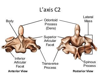 L’axis	C2	
Odontoid
Process
(Dens)
Body
Transverse
Process
Inferior
Articular
Facet
Superior
Articular
Facet
Anterior	View	 Posterior	View	
Lateral
Mass
Spinous
Process
 