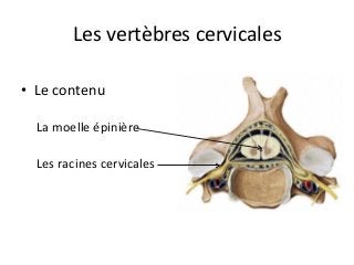 •  Le	contenu		
La	moelle	épinière	
Les	racines	cervicales		
	
Les	vertèbres	cervicales	
 