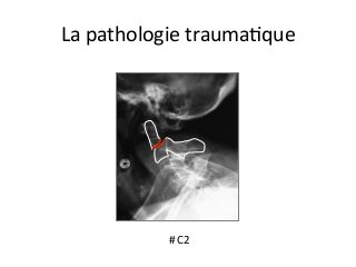 #	C2	
La	pathologie	traumaJque	
 