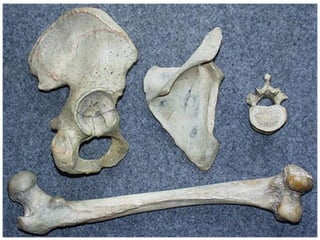 20/10/2007
Dr. ABDALLAH - Appareil locomoteur
11
 