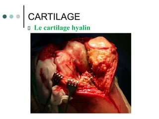 CARTILAGE
Le cartilage hyalin
Dr. ABDALLAH - Appareil locomoteur
 