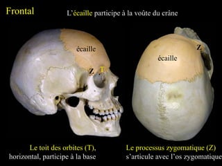 Frontal
écaille
L’écaille participe à la voûte du crâne
écaille
Le toit des orbites (T),
horizontal, participe à la base
T
Z
Z
Le processus zygomatique (Z)
s’articule avec l’os zygomatique
 