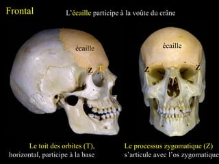 Frontal
écaille
L’écaille participe à la voûte du crâne
écaille
Le toit des orbites (T),
horizontal, participe à la base
T
Z Z
Le processus zygomatique (Z)
s’articule avec l’os zygomatique
Z
 