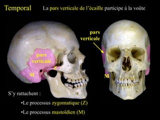 Temporal La pars verticale de l’écaille participe à la voûte
pars
verticale
S’y rattachent :
•Le processus mastoïdien (M)
M
•Le processus zygomatique (Z)
Z
pars
verticale
M
 