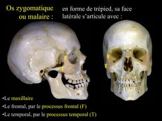 Os zygomatique
ou malaire :
en forme de trépied, sa face
latérale s’articule avec :
•Le maxillaire
•Le frontal, par le processus frontal (F)
F F
•Le temporal, par le processus temporal (T)
T
T
 