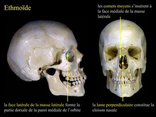 Ethmoïde
la face latérale de la masse latérale forme la
partie dorsale de la paroi médiale de l’orbite
la lame perpendiculaire constitue la
cloison nasale
les cornets moyens s’insèrent à
la face médiale de la masse
latérale
 