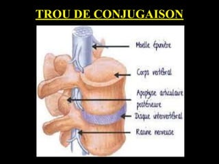 TROU DE CONJUGAISON
 