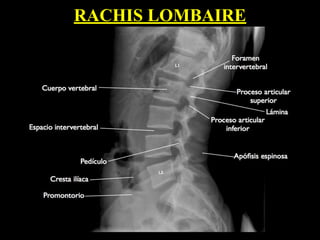 RACHIS LOMBAIRE
 