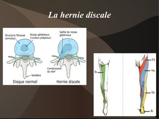 Les ligaments du genou Le pivot centrale: 