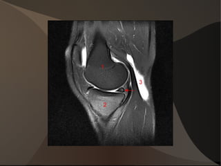 Théorie: le genou en mouvement Squelette pour le soutien Muscle pour le mouvement Ligament  pour le maintien 