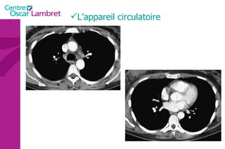 L’appareil circulatoire 