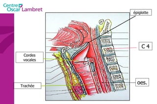 C 4 oes. Trachée Cordes vocales épiglotte 