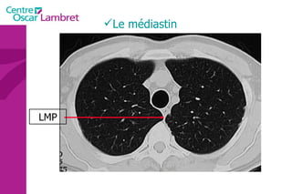 Le médiastin LMP 