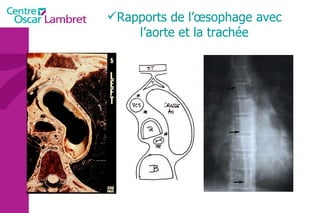 Rapports de l’œsophage avec l’aorte et la trachée 