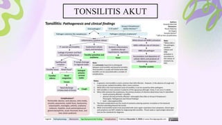 TONSILITIS AKUT
 