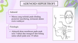 • Massa yang terletak pada dinding
posterior nasofaring, termasuk dalam
cicin waldeyer
Adenoid
• Adenoid akan membesar pada anak
usia 3 tahun dan mengecil dan hilang
sama sekali pada usia 14 tahun
Fisiologis
ADENOID HIPERTROFI
 