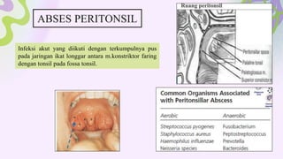 ABSES PERITONSIL
Infeksi akut yang diikuti dengan terkumpulnya pus
pada jaringan ikat longgar antara m.konstriktor faring
dengan tonsil pada fossa tonsil.
 
